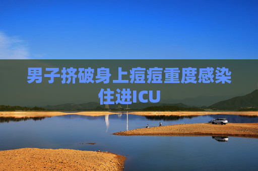 男子挤破身上痘痘重度感染住进ICU  第1张