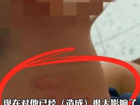 男孩未戴红领巾被校长掐脖，家长：不是第一次了